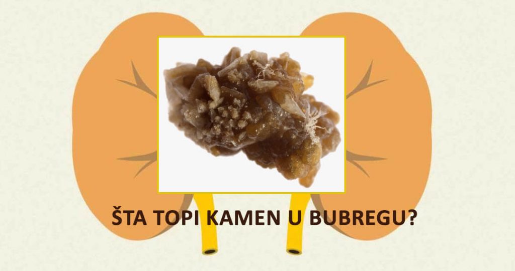 Topljenje kamena u žuči - simptomi i prirodno lečenje