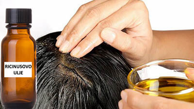kako se koristi ricinusovo ulje za kosu